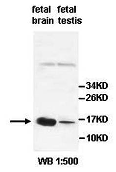 AGRP Rabbit Polyclonal Antibody