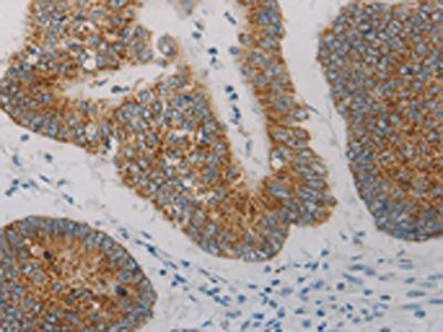 AIFM1 Antibody