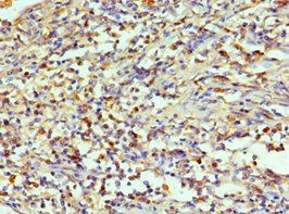 AIMP1 Antibody