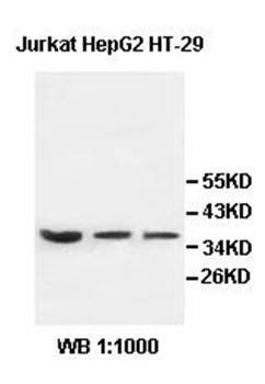 AIP Rabbit Polyclonal Antibody