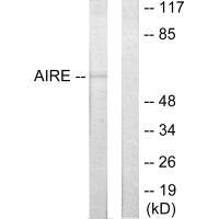 AIRE Antibody