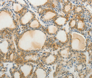 AKAP1 Antibody