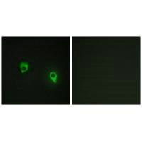 AKAP1 Antibody