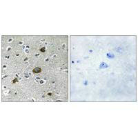 AKAP1 Antibody