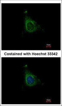 AKAP10 Rabbit Polyclonal Antibody