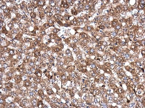 AKAP10 Rabbit Polyclonal Antibody