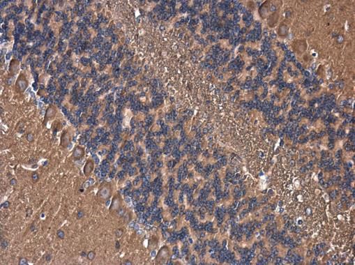 AKAP10 Rabbit Polyclonal Antibody