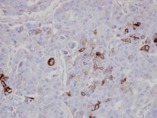 AKAP10 Rabbit Polyclonal Antibody