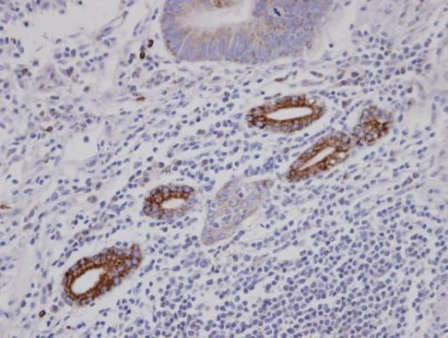 AKAP10 Rabbit Polyclonal Antibody
