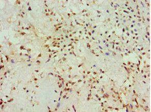 AKAP13 Antibody