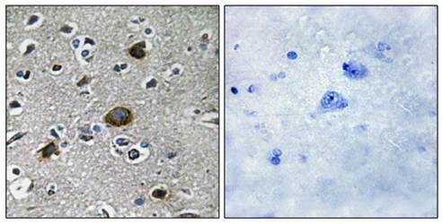 AKAP1 Antibody