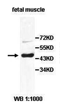 AKAP5 Rabbit Polyclonal Antibody