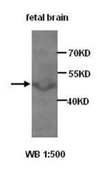 AKAP7 Rabbit Polyclonal Antibody