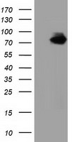 AKR1A1 Antibody