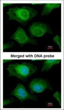 AKR1B10 Rabbit Polyclonal Antibody
