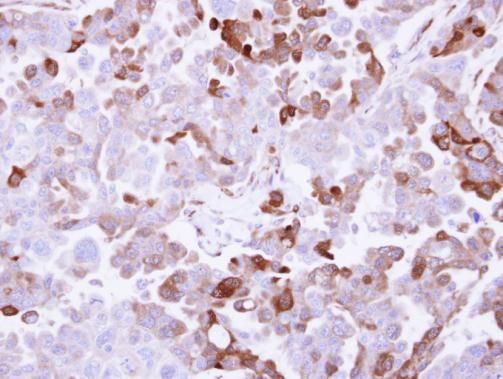 AKR1B10 Rabbit Polyclonal Antibody