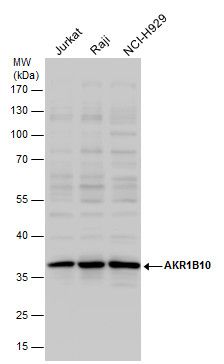 AKR1B10 Rabbit Polyclonal Antibody
