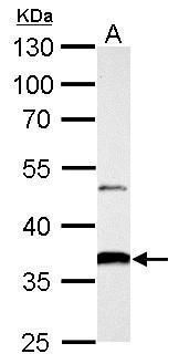 AKR1B10 Rabbit Polyclonal Antibody