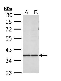 AKR1B10 Rabbit Polyclonal Antibody