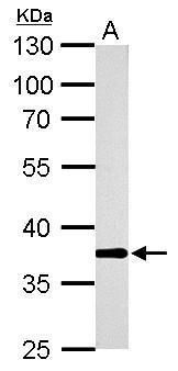 AKR1B10 Rabbit Polyclonal Antibody