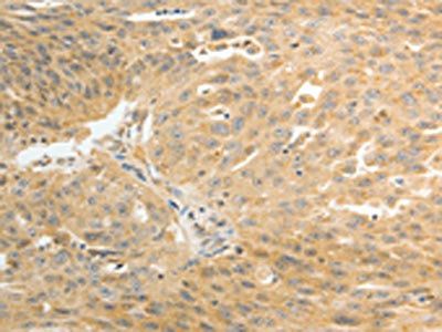 AKR1C1 Antibody