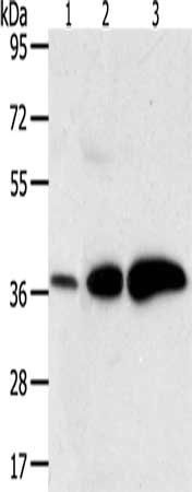AKR1C1 Antibody
