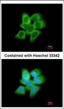 AKR1C1 Rabbit Polyclonal Antibody