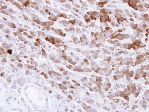 AKR1C1 Rabbit Polyclonal Antibody