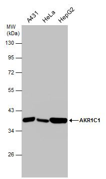 AKR1C1 Rabbit Polyclonal Antibody