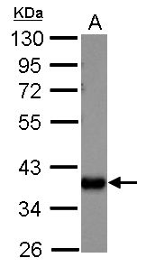AKR1C1 Rabbit Polyclonal Antibody