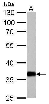 AKR1C1 Rabbit Polyclonal Antibody