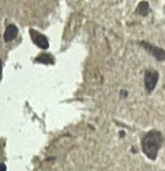 AKR1C1 Rabbit Polyclonal Antibody