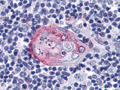 AKT2 Antibody