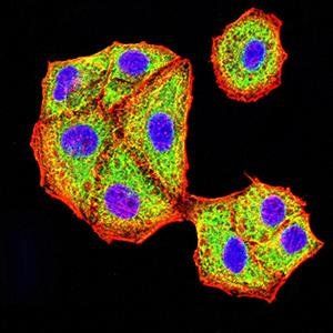 AKT3 Antibody