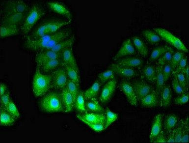 GPT Antibody
