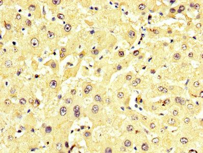 GPT Antibody