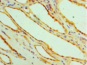 GPT Antibody