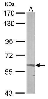 5'-aminolevulinate synthase 2 Antibody
