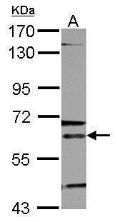 5'-aminolevulinate synthase 2 Antibody