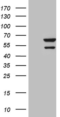 ALAS1 Antibody