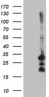 ALDH3A2 Antibody