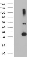 ALDH3A2 Antibody