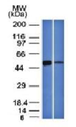ALDH1A1 Antibody