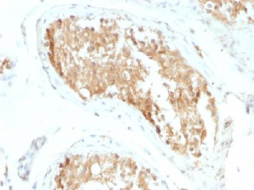 ALDH1A1 Antibody