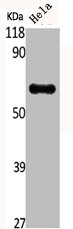 ALDH1B1 Antibody