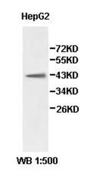ALDH3B2 Rabbit Polyclonal Antibody