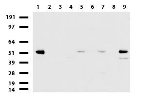 ALDH7A1 Antibody