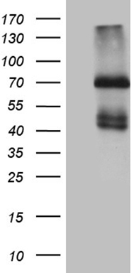 ALDH7A1 Antibody