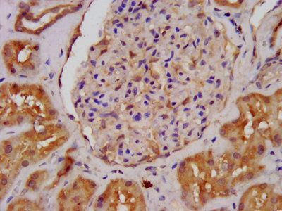 ALDH7A1 Antibody