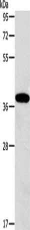 ALDOB Antibody